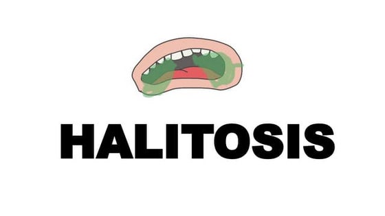 Oral Malodor.pptx jsjshdhushehsidjjeiejdhfj