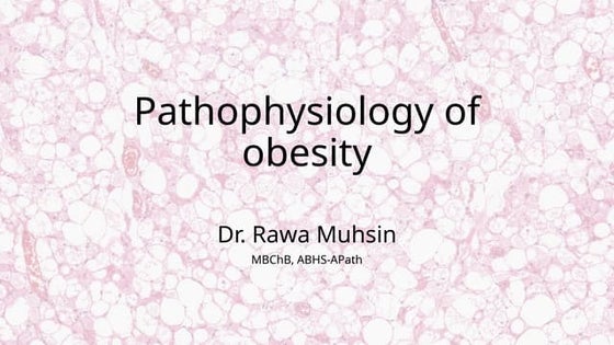 Pathophysiology of obesity - Rawa Muhsin